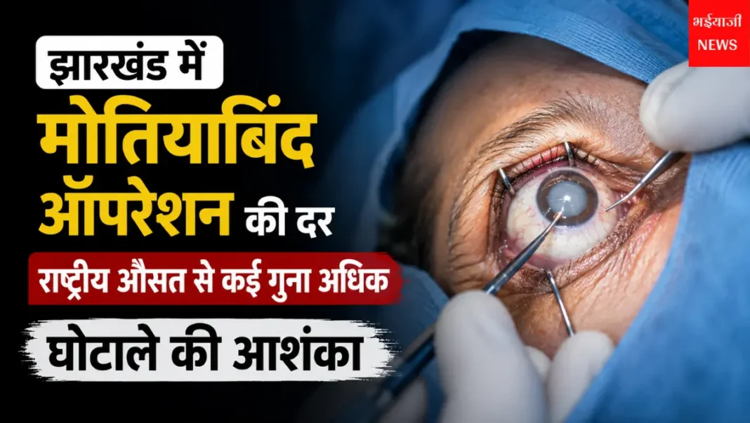 झारखंड मोतियाबिंद ऑपरेशन घोटाला : | Jharkhand News | Bhaiyajii News |