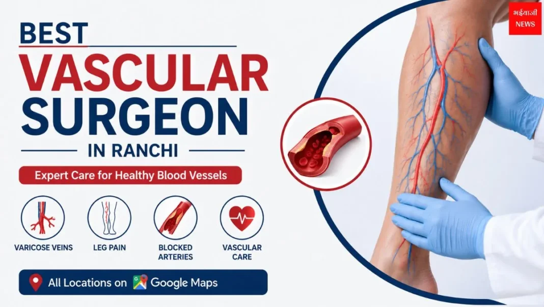 Vascular Surgeon in Ranchi | Jharkhand News | Bhaiyajii News